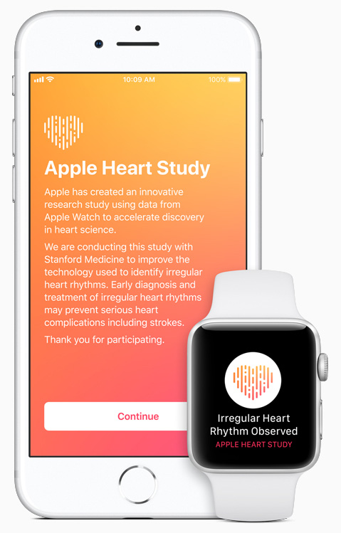 斯坦福醫藥研究發現 Apple Watch 可檢測心房顫動 | Apple News, Apple Watch, ECG心電圖 | iPhone News 愛瘋了