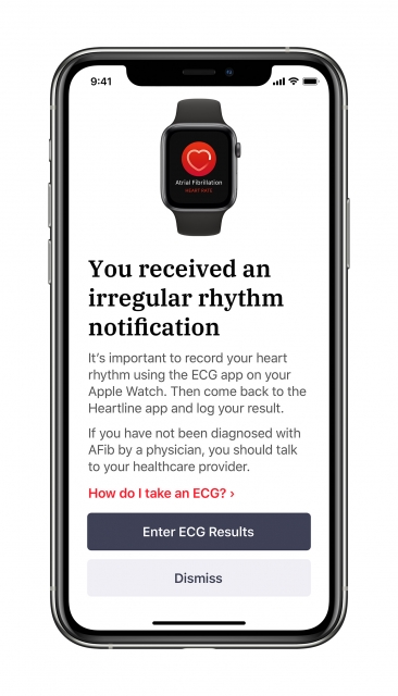 蘋果與強生合作研究用 Apple Watch 降低中風風險 | AFib, Apple News, Apple Watch, Heartline | iPhone News 愛瘋了