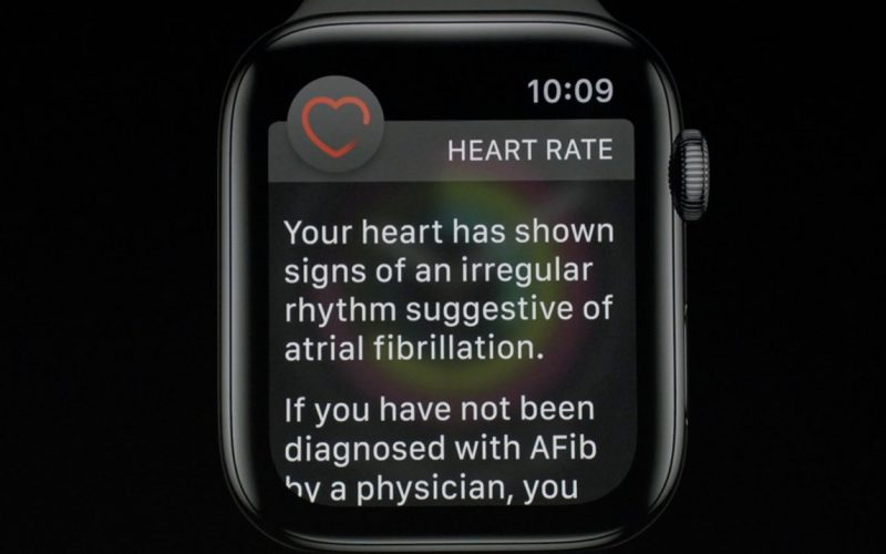 Apple Watch 的心律不整監測救了 70 歲老奶奶生命