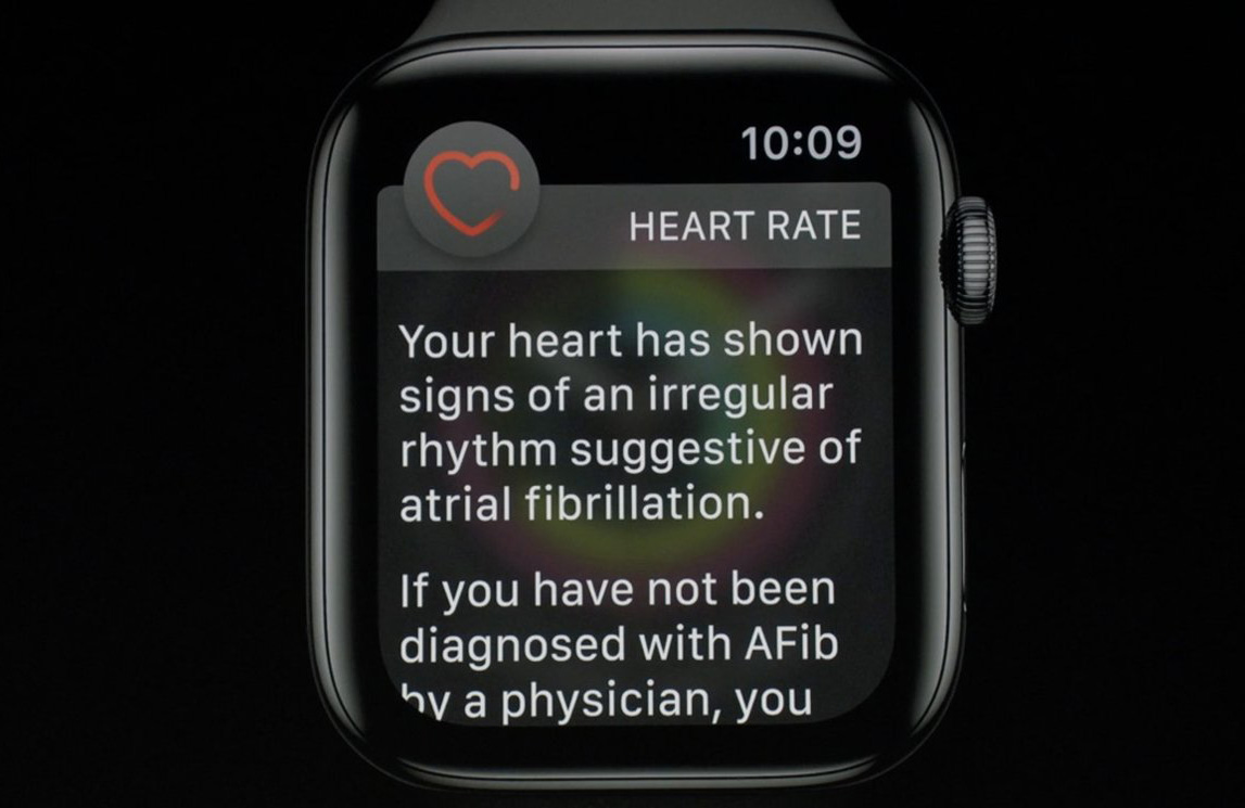 Apple Watch 的心律不整監測救了 70 歲老奶奶生命