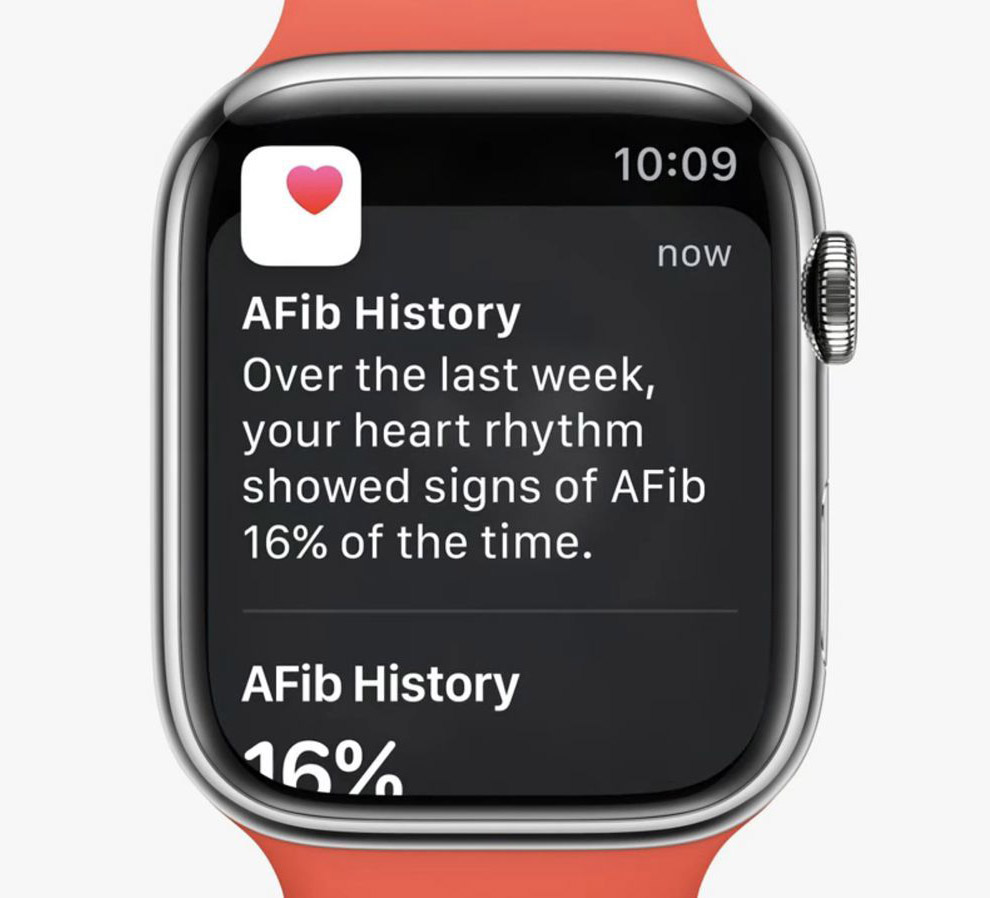 加拿大批准 Apple Watch 的心房顫動歷史功能 | AFib, Apple Watch, 心房顫動, 房顫, 蘋果手錶 | iPhone News 愛瘋了