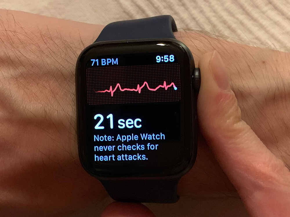 Apple Watch在與AliveCor的心電圖專利戰取得勝利
