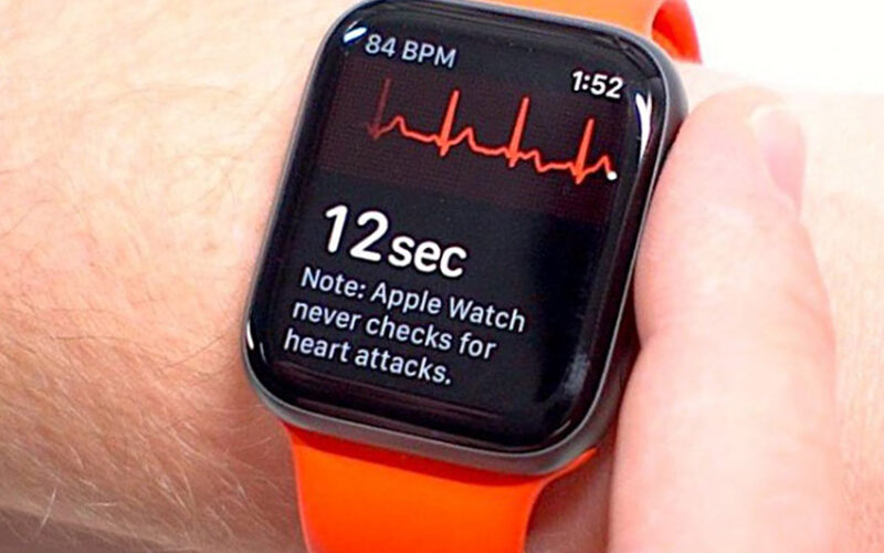 瑞士研究：Apple Watch 提供最佳的心電圖品質和可讀性