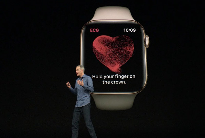 瑞士研究：Apple Watch 提供最佳的心電圖品質和可讀性