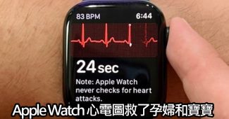 apple watch ecg feature saves pregnant woman