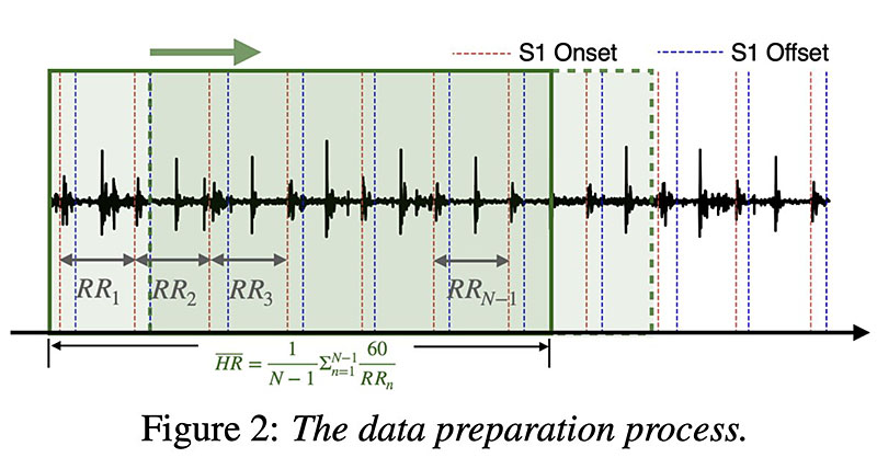 apple airpods ai heart monitoring study 3