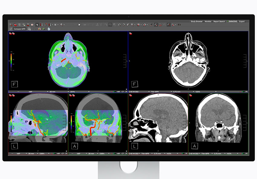 apple studio display xdr dicom fda approved apple studio display xdr dicom fda approved